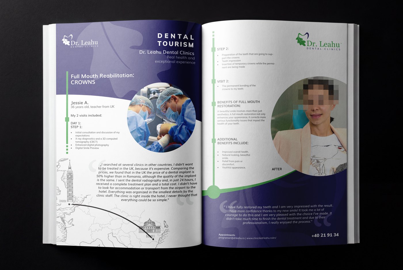 Broșura de dental tourism Dr. Leahu, deschisă la reabilitarea completă